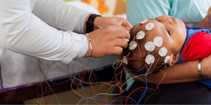 Pediatric Neurosurgery in Agra